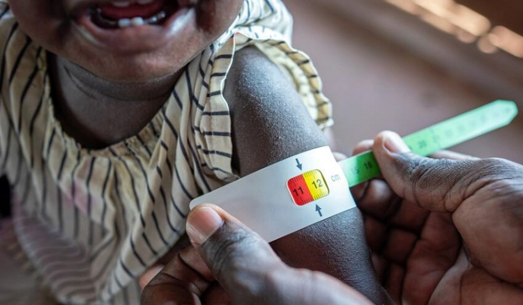 Insegurança alimentar cresce no mundo e tende a agravar-se